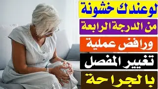 علاج خشونة الركبة من الدرجة الرابعة /أ.د.محمد حمادة أستاذ علاج الألم بطب الازهر