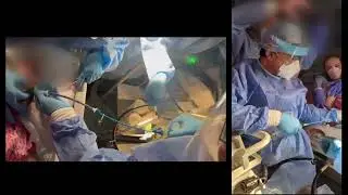 REFRACTORY VARICEAL BLEED &ndash; DANIS STENT & TIPSS