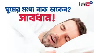 Snoring while sleeping could be sleep apnea, doctors share guidelines | Sangbad Pratidin