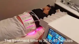 Xara Skin Clinic laser liposuction fat removal Sydney