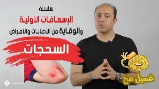 السحجات - غسيل مخ - سلسلة الإسعافات الأولية