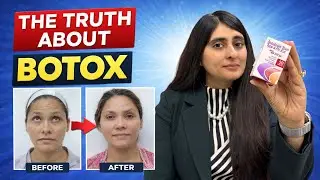 Botox | Botox Treatment for face | Botox Cost in India | Wrinkle Treatment Delhi | Wrinkle Removal