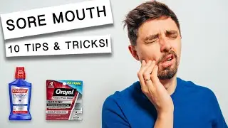 10 Tips to Heal A Sore Mouth | Relieve Pain at Home with Doctor's Tricks👨&zwj;⚕️🔍