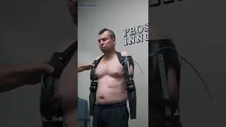 Victor Bilateral Trans-Humeral Prosthetic Elbow Placement | Prosthetic Innovations