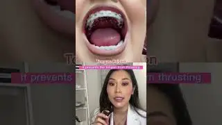 Tongue prison! #orthodontics #dentist #teeth #braces