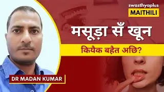 ब्लीडिंग गम के इलाज केना करब? | Treatment of Bleeding Gums in Maithili | Dr Madan Kumar