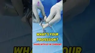 Self Retaining Retractor | Surgical Instrument #retractor #surgicalinstruments #surgicaltools #short