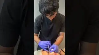 #aesthetician #shortsfeed #beauty #skintreatment #aesthetic #zain