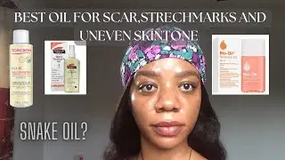 Best body oil for scars and stretch mark