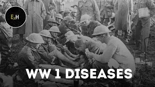 Diseases Suffered By Soldiers In World War 1