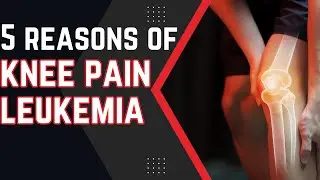 5 Reasons of Knee Pain Leukemia| Knee Pain Leukemia Treatment| Sleepinsta