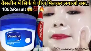 Vaseline में Colgate मिलाकर लगाओ आपके चेहरे और हाथ पैर इतने गोरे हो जाएंगे कि सब चौक जाएंगे