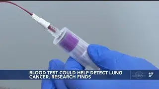 Research finds blood test may help detect lung cancer