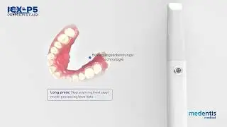 ICX-P5 Intraoralscanner &ndash; Digital. Pr&auml;zise. Effizient.