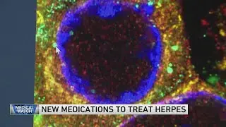 New medications to treat herpes &mdash; and more health headlines