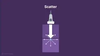 Ultrasound Physics Explained - What causes attenuation of sound waves?