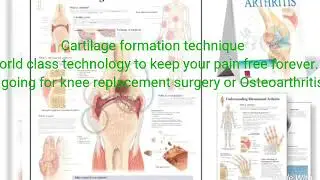 Cartilage formation technique