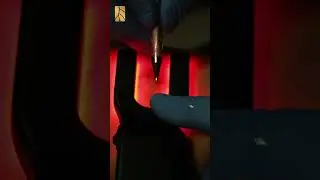 Tratamento de varizes individualizado