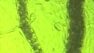 The BEMER Effect  &ndash;  Microscopic demonstration of the effect on microcirculation