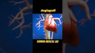 Angiografie procedure #laboratory #medicallab #humanbodysystem #youtubeshorts #medicallaboratory