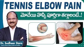How to Cure Tennis Elbow Pain | Elbow Pain Treatment in Telugu | PRP for Elbow Pain Relief | Epione