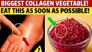 8 Collagen Rich Vegetables You MUST Eat for Your LEGS and JOINTS