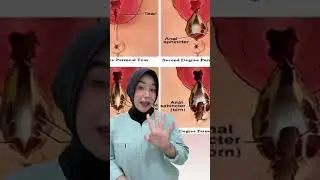 ini dia tips perawatan setelah melahirkan normal #ytshorts #edukasipersalinan #bidansilvia