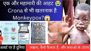 Monkeypox Virus क्या है|Monkeypox Symptoms & Treatment in Hindi|Monkeypox virus|What is Monkeypox