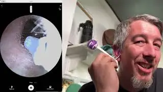 Trying the X6-B Earwax removal camera/tool
