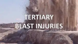 Types of Blast Injuries