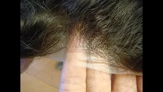 (2021)Protesi capelli skin 0,02/ Tutti i colori / stock hair replacement systems/ protesis capilares