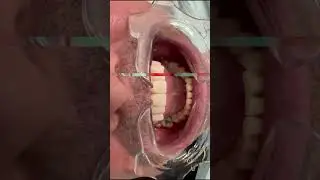 You have to see this transformation