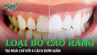 Loại Bỏ Cao Răng Tại Nhà Chỉ Với 4 Cách Đơn Giản I SKĐS
