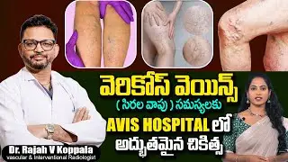 Varicose Veins, సిరల వాపు సమస్యలకు AVIS HOSPITAL లో Best Treatment | SumanTv Sandhya
