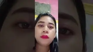Bumil epil lgi