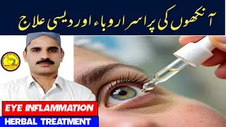 👁️ Eye Inflammation Treatment | Causes, Symptoms & Natural Remedies | Herbal world 