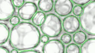 Deep learning for bubble detection