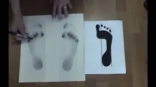 Natural Foot Orthotics Overview