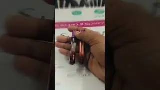 blood sample #collection #blood #edta #trending
