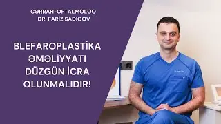 Cərrah-Oftalmoloq Fariz Sadıqov Blefaroplastika haqqında məlumat verdi 👍 ✅