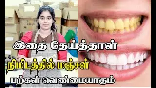 Magical Teeth Whitening at home instantly 😍😬 | How To Have Natural White Teeth in 3 minutes