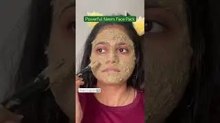 This Powerful Neem Facepack For acne, dark spots & pigmentation 🍃 #facepack #skincare #ytviral #yt