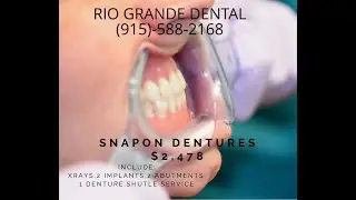 Best Dentist in Juarez Mexico