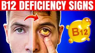 The 1 Vitamin That REVERSES Nerve Damage (Never Ignore B12 deficiency)