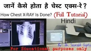 कैसे लिया जाता है छाती का एक्स-रे?(Inside X-RAY Room) | How Chest X-RAY is Done? | Full Explaination