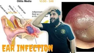 Har cheez doctor ko dekhana zaroori nahi | Baal katwane ki wajah | Molvi Bashar Vlogs