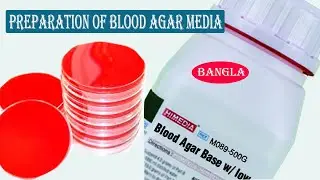 Blood Agar Preparation | Blood Agar Media Preparation Procedure