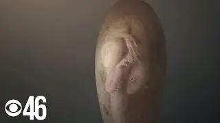 72-million-year-old dinosaur embryo found in fossilized egg