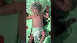 New born 👦after barth so beautiful baby 🐥🥰