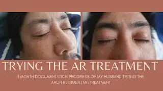 My Husband's Skin Progress Using Aron Regimen (AR) Treatment For His Eczema | Feebie&BeejayVlogs
